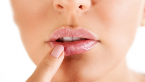 Mujer con herpes labial