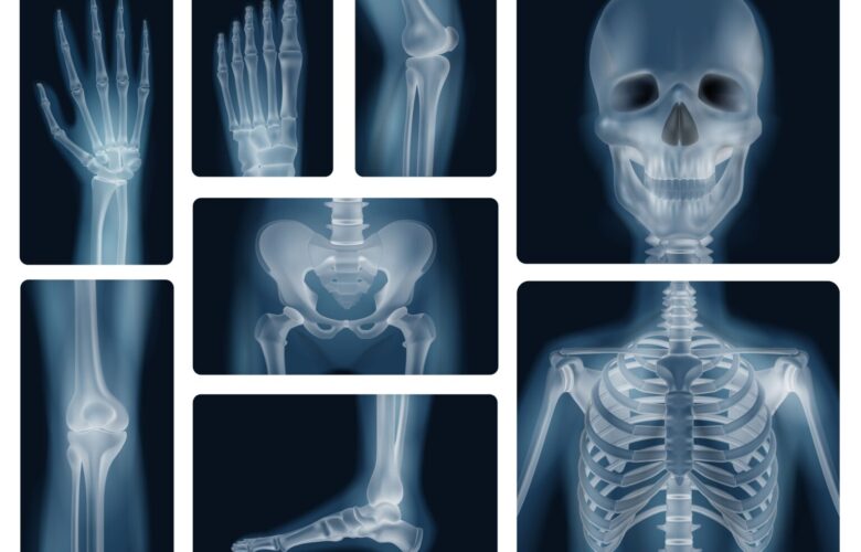 Radiografías de distintas partes del cuerpo
