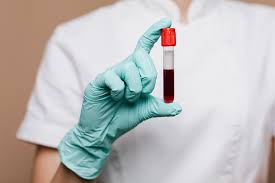 personal de la salud con un tubo de sangre en la mano