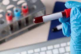 muestra de sangre