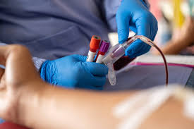 tomando muestra de sangre