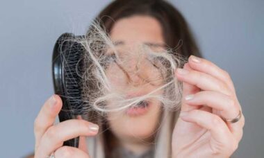 mujer con el cepillo lleno de cabello, preocupada por la pérdida del mismo